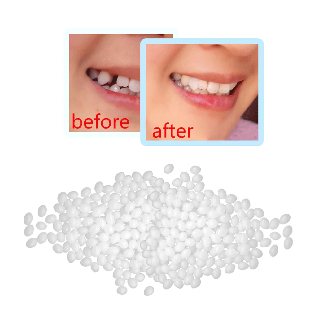 DenturePro™ | DIY Tooth Repair Kit